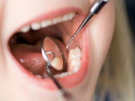 Close up of childs mouth during dental examination