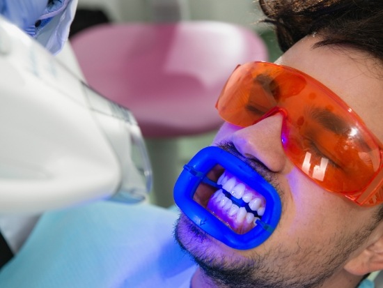 In office teeth whitening procedure