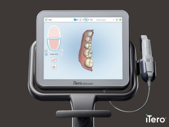 Shot of dental scan on iTero digital impression system